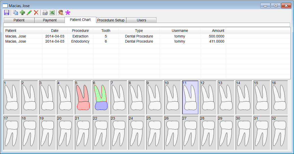 Tooth11Selected